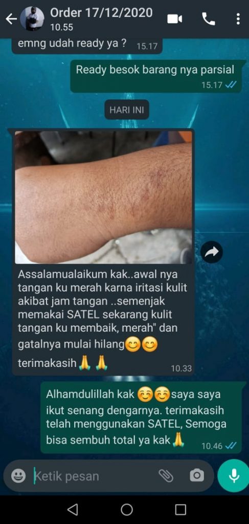 testi gtl