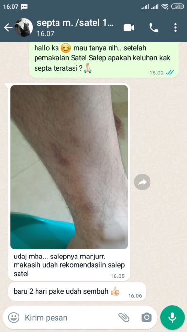 testi satel4