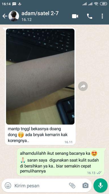 testi satel6